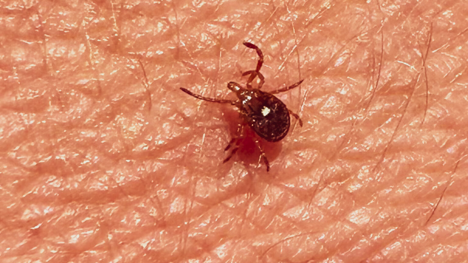 Best Products to Keep Ticks Off Your Body